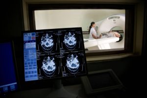 IGC Pharma’s AHA AI Cuts Alzheimer’s Data Harmonization Time 90%