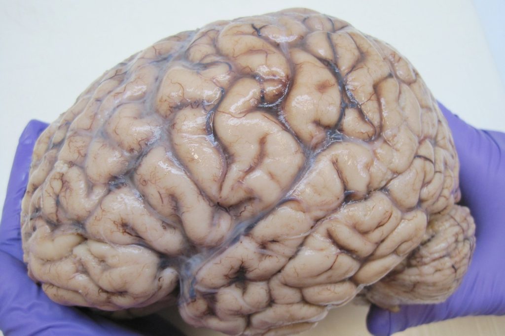 Your Brain Beats AI Detectors: How to Spot Fake Text
