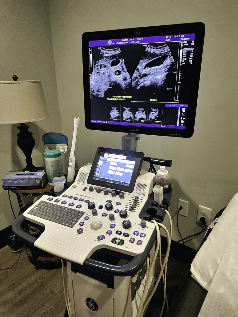 Ultrasound Machine