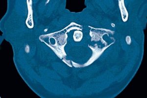AI Agents Outperform Physicians in Diagnostic Accuracy, Study Shows