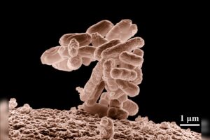 AI-Designed Viruses Kill E. coli in Lab Tests, Raising Biosecurity Concerns
